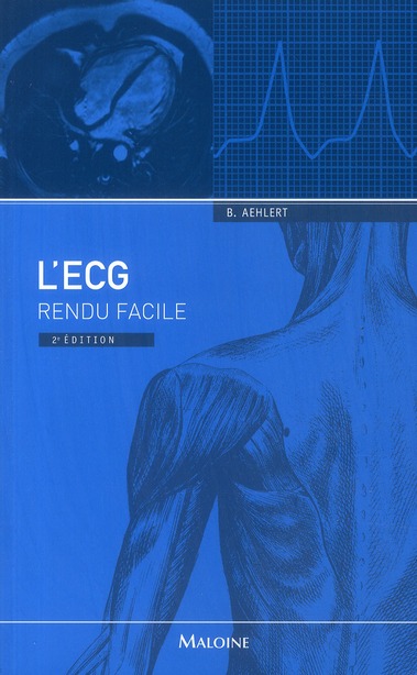 L'ECG rendu facile. 2e édition