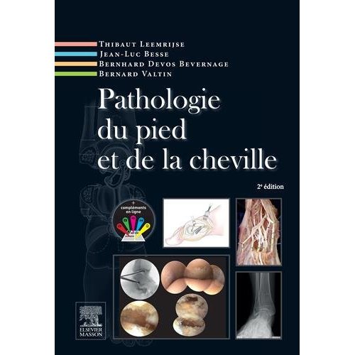 Pathologie du pied et de la cheville. 2e édition