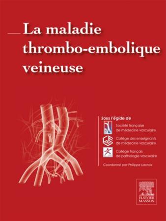 La maladie thrombo-embolique veineuse