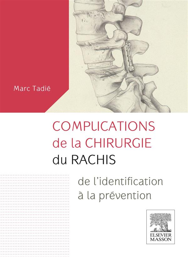 Complications de la chirurgie du rachis. De l'identification à la prévention