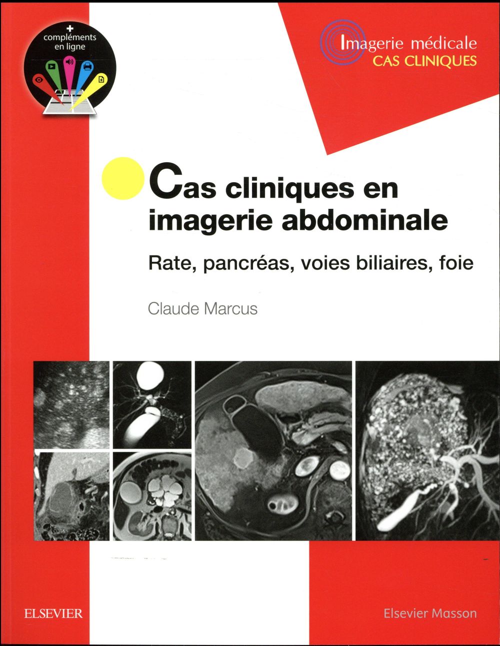 Cas cliniques en imagerie abdominale. Rate, pancréas, voies biliaires, foie
