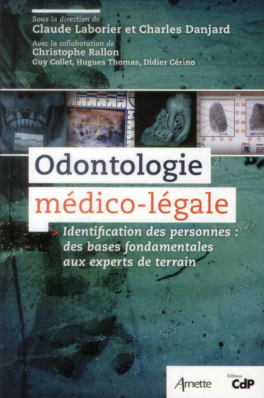 Odontologie médico-légale. Identification des personnes : des bases fondamentales aux experts de ter