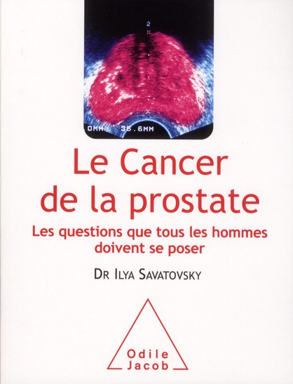 Le cancer de la prostate. Les questions que tous les hommes doivent se poser