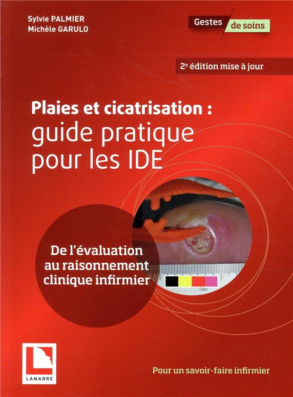 Plaies et cicatrisation : guide pratique pour les IDE