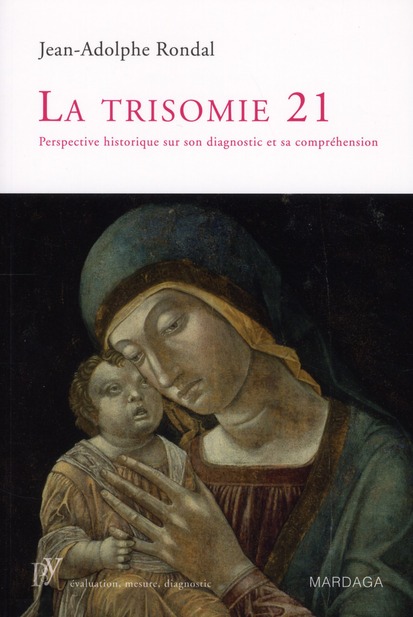 La trisomie 21. Perspective historique sur son diagnostic et sa compréhension