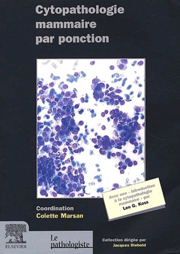 Cytopathologie mammaire par ponction