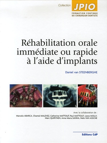 Réhabilitation orale immédiate ou rapide à l'aide d'implants
