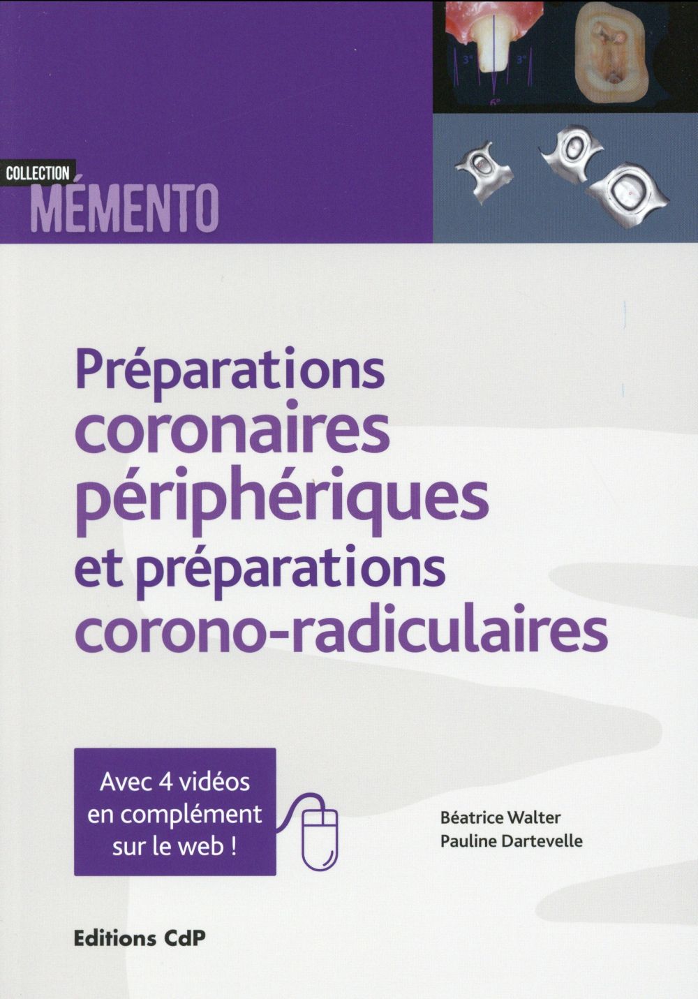 Préparations coronaires périphériques et préparations corono-radiculaires