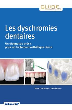 Les dyschromies dentaires. Un diagnostic précis pour un traitement esthétique réussi