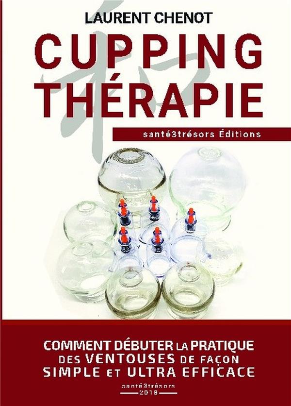 Cupping thérapie. Comment débuter la pratique des ventouses de façon simple et ultra efficace