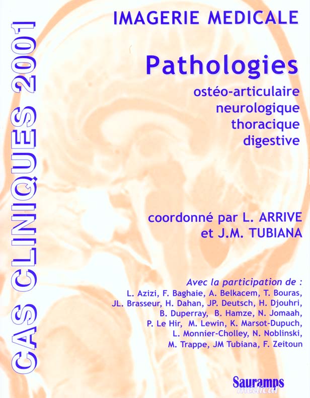 Imagerie médicale. Pathologies ostéo-articulaire, neurologique, thoracique, digestive, ORL, édition