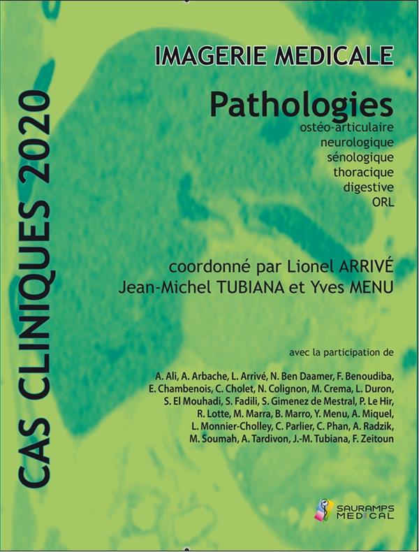 Imagerie médicale. Pathologies ostéo-articulaire, neurologique, sénologique, thoracique, digestive,