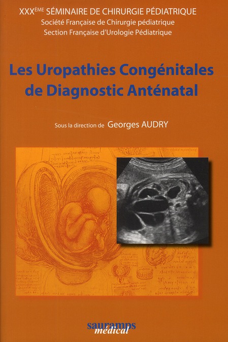 Les uropathies congénitales de diagnostic anténatal. 30e séminaire de chirurgie pédiatrique