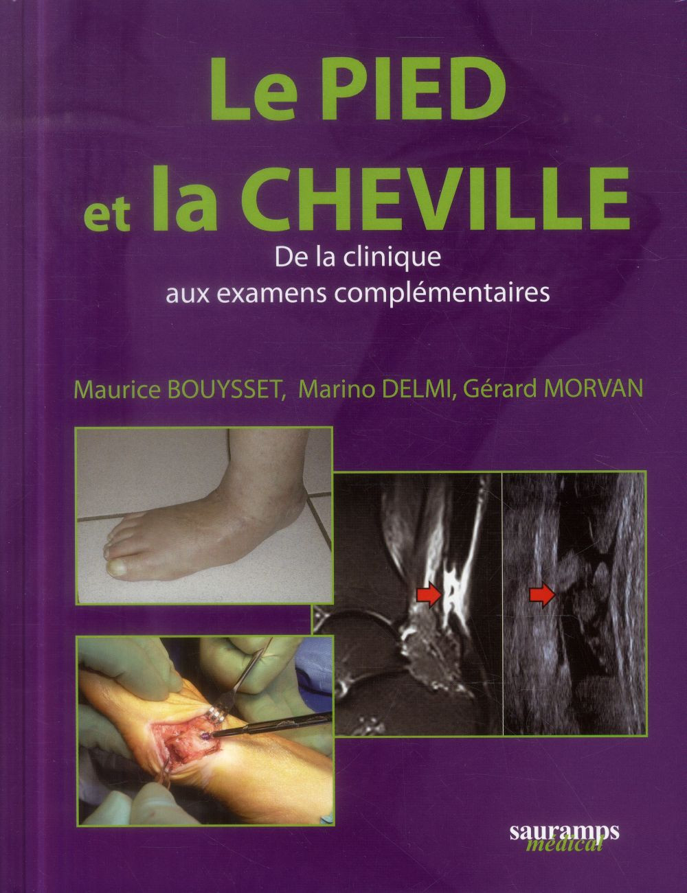 Le pied et la cheville. De la clinique aux examens complémentaires