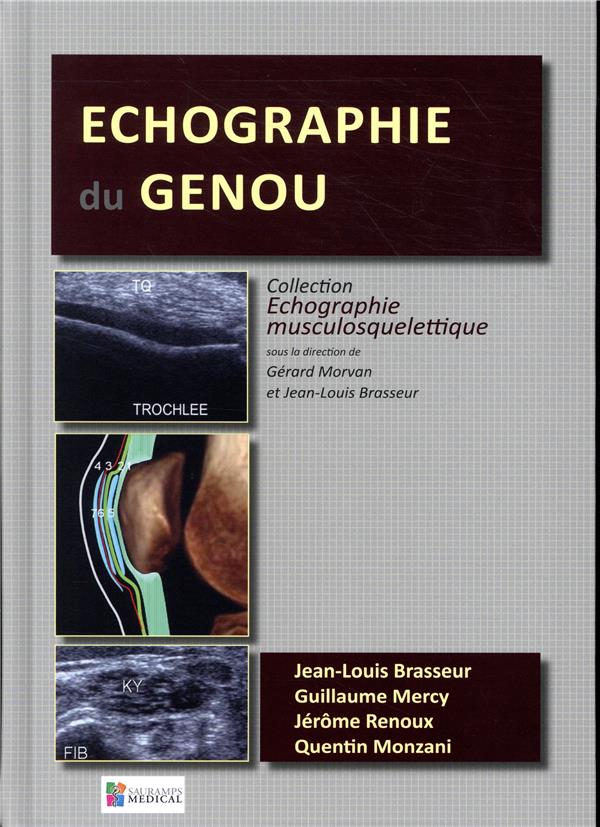 Echographie du genou