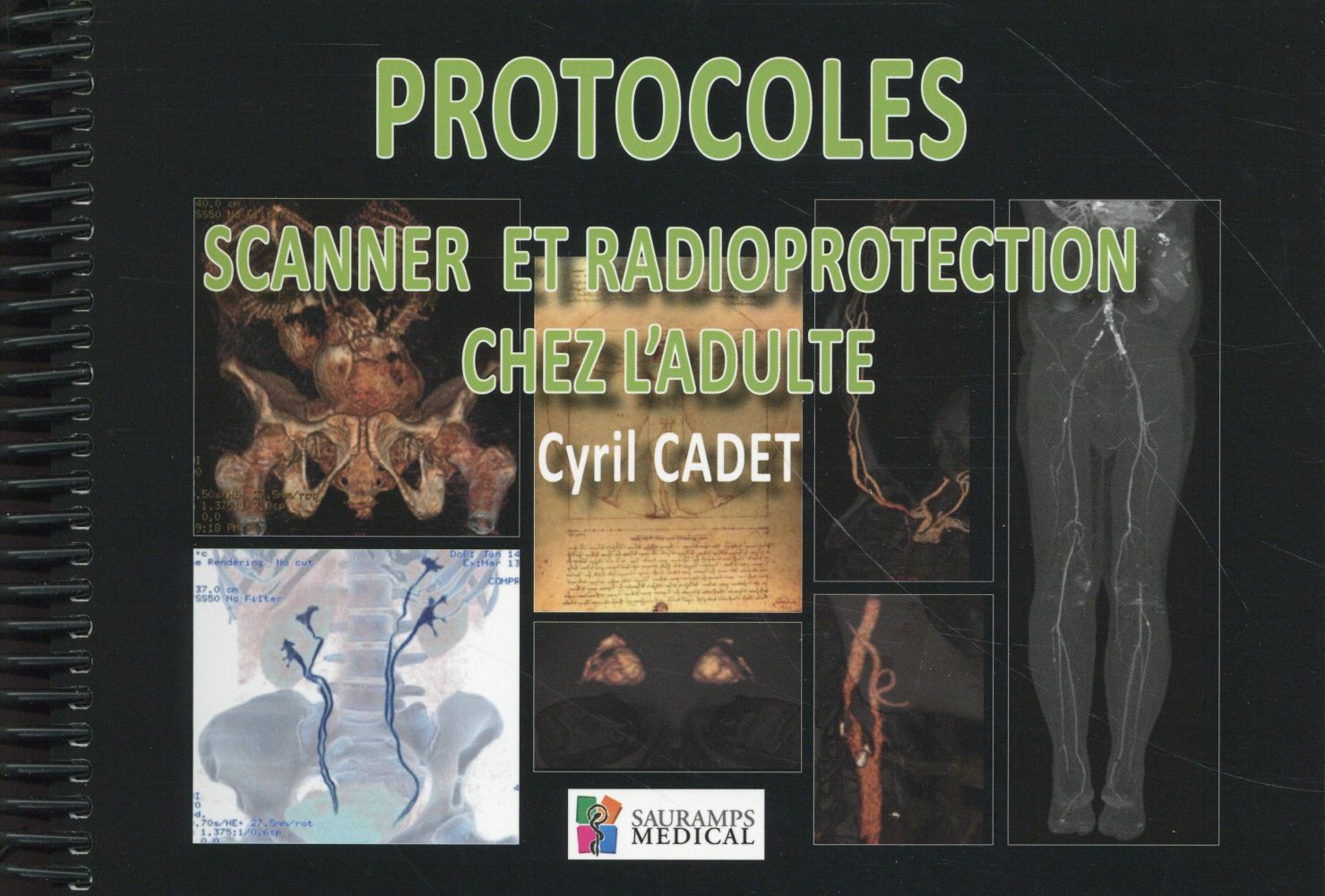 Protocoles scanner et radioprotection chez l'adulte