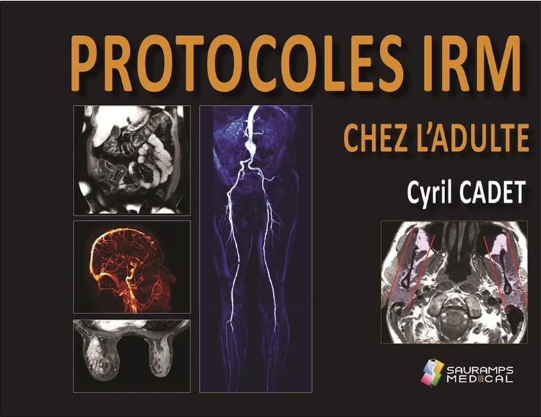 Protocoles IRM chez l'adulte