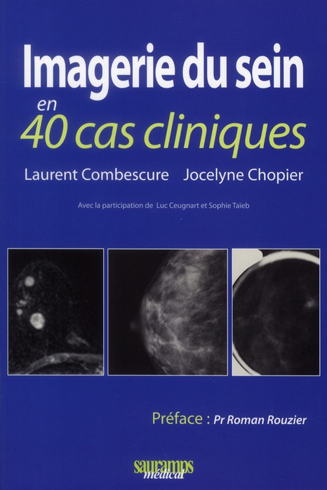 Imagerie du sein en 40 cas cliniques