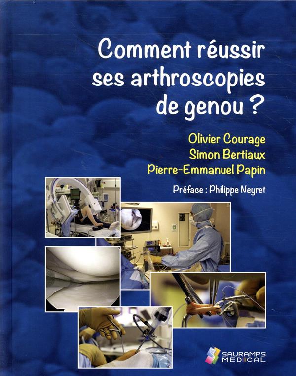 Comment réussir ses arthroscopies de genou ?