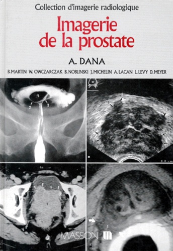 IMAGERIE DE LA PROSTATE