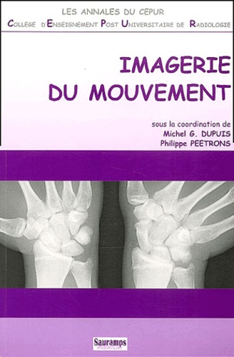 Imagerie du mouvement