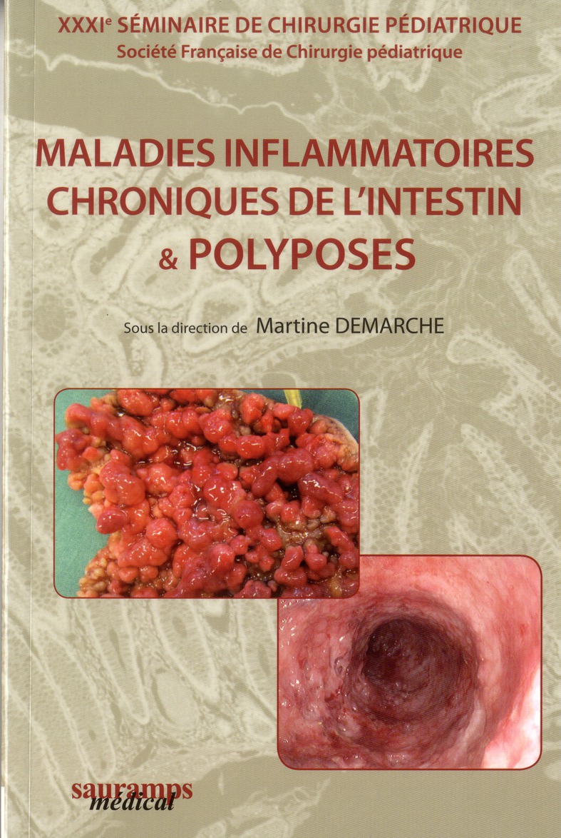 Maladies inflammatoires, chroniques de l'intestin & polyposes. 31e séminaire de chirurgie pédiatriqu