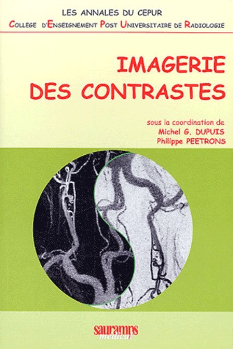 Imagerie des contrastes