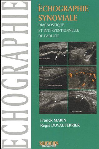 Echographie synoviale diagnostique et interventionnelle de l'adulte