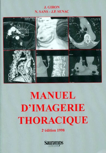 MANUEL D'IMAGERIE THORACIQUE. 2ème édition 1998