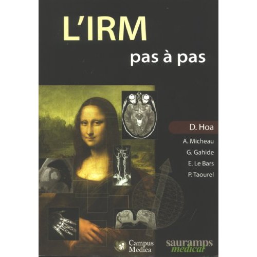 L'IRM pas à pas