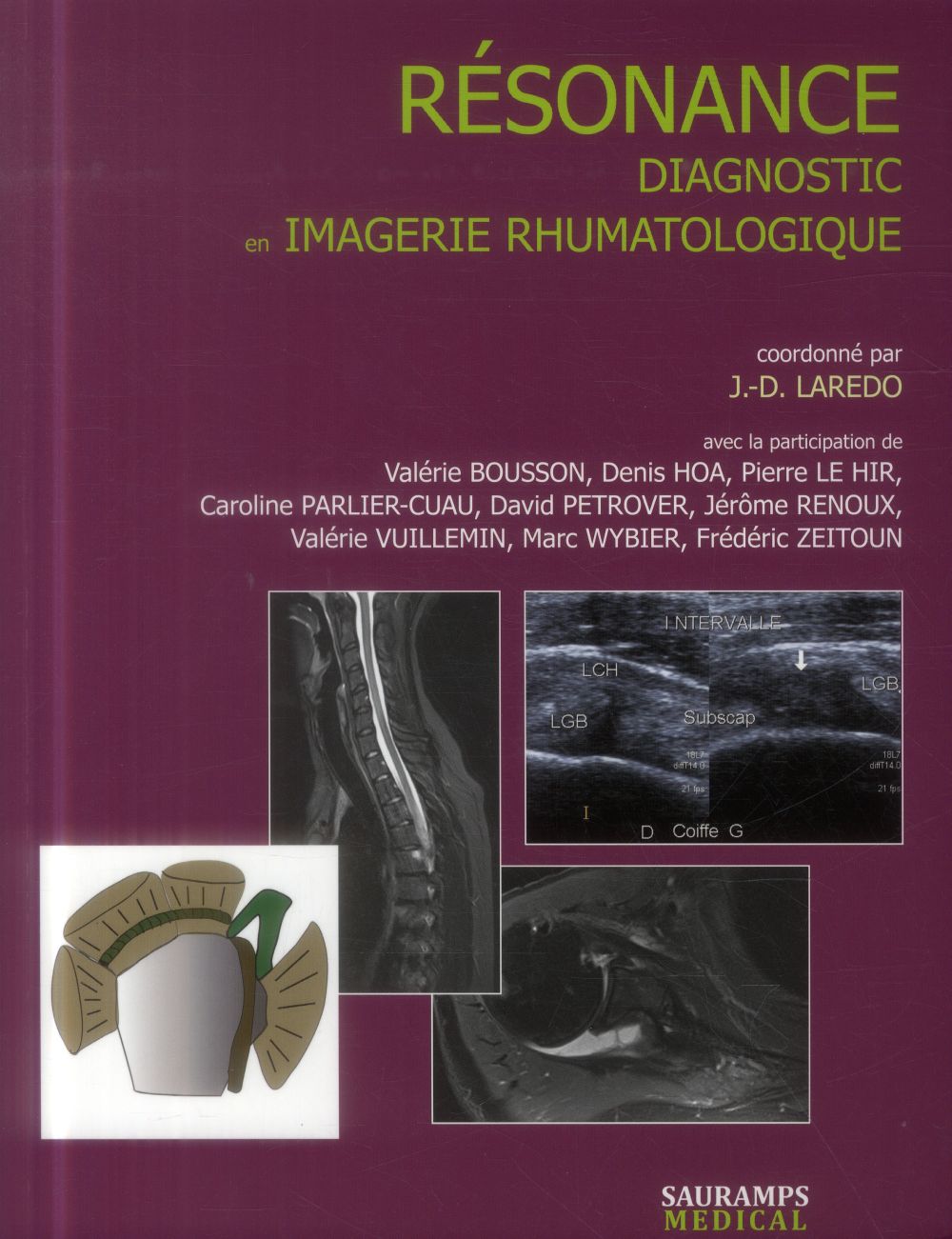 Résonance. Diagnostic en imagerie rhumatologique