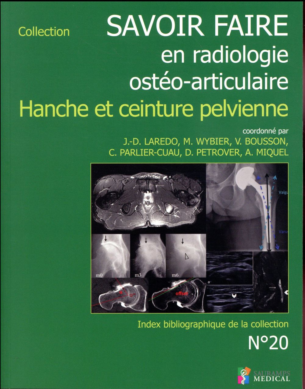 Hanche et ceinture pelvienne