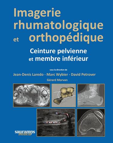 Imagerie rhumatologique et orthopédique. Tome 3, Ceinture pelvienne et membre inférieur