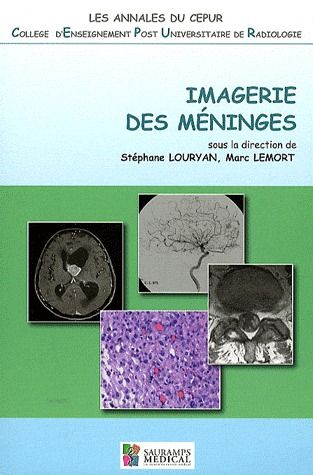 Imagerie des méninges