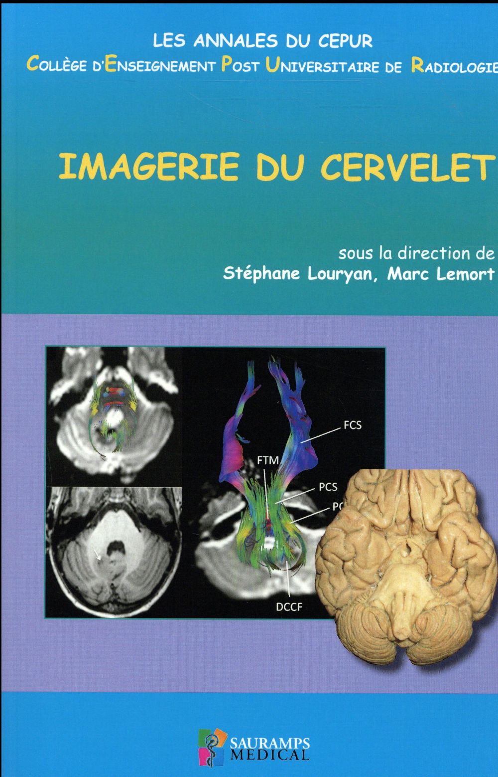 Imagerie du cervelet