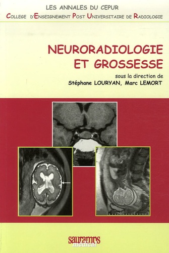 Neuroradiologie et grossesse