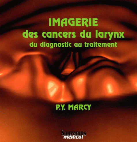 Imagerie des cancers du larynx. Du diagnostic au traitement, avec 1 CD-ROM