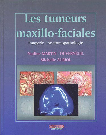Les tumeurs maxillo-faciales. Imagerie - Anatomopathologie