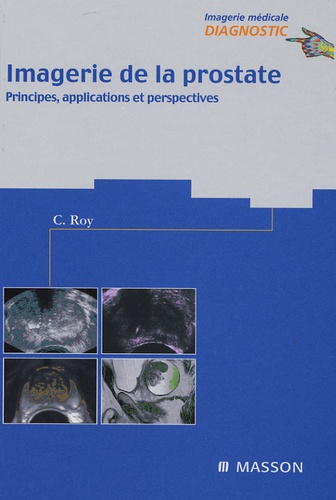 IMAGERIE DE LA PROSTATE - PRINCIPES, APPLICATIONS ET PERSPECTIVES