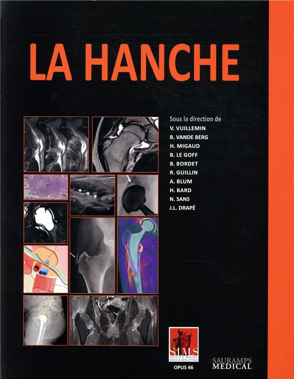 La hanche