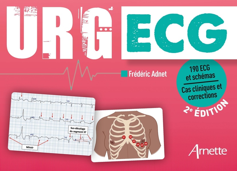 URG' ECG. 2e édition