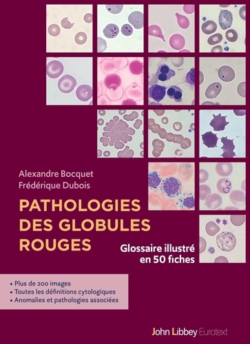 Pathologies des globules rouges. Glossaire illustré en 50 fiches