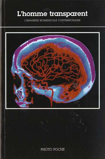 L'homme transparent. L'imagerie biomédicale contemporaine