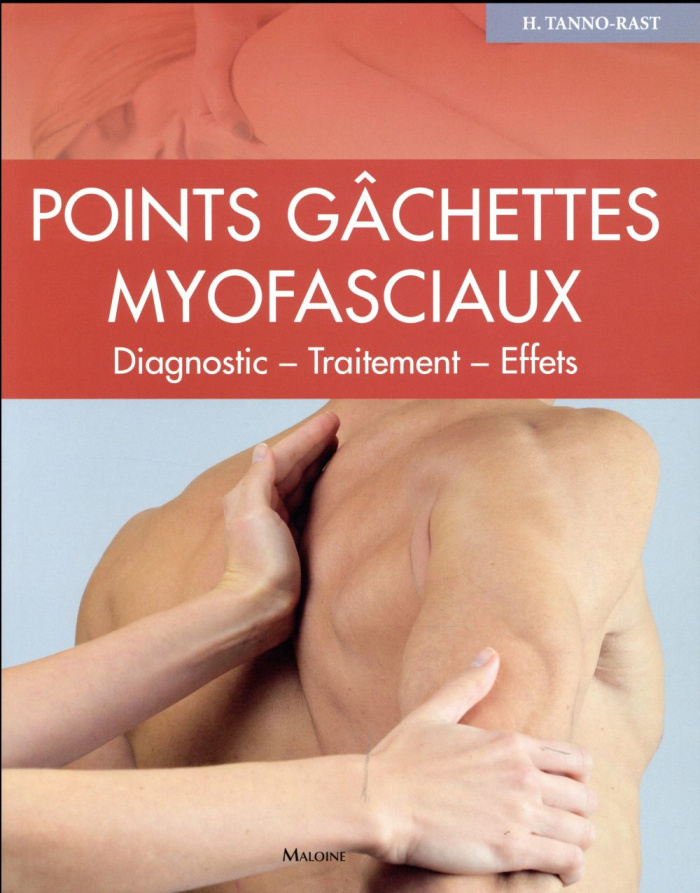 Points gâchettes myofasciaux. Diagnostics - Traitement - Effets