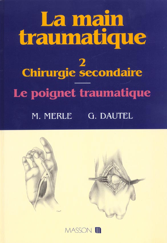 La main traumatique. Tome 2