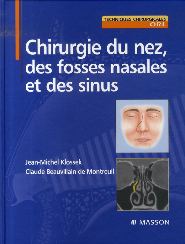 Chirurgie du nez, des fosses nasales et des sinus