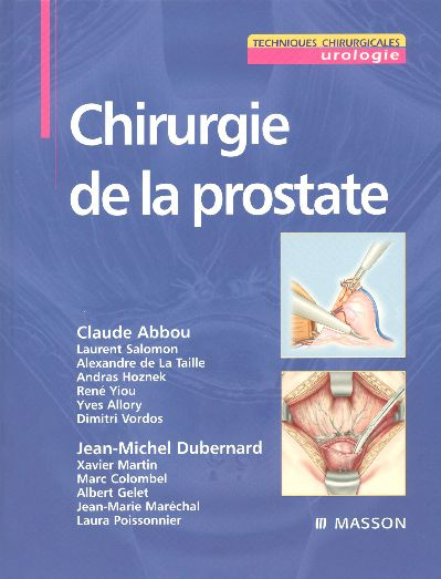 Chirurgie de la prostate