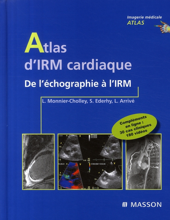 Atlas d'imagerie cardiaque. De l'échographie à l'IRM
