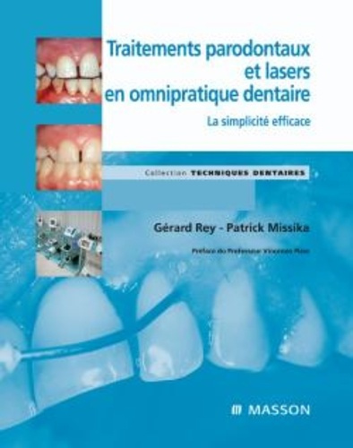 Traitements parodontaux et lasers en omnipratique dentaire. La simplicité efficace