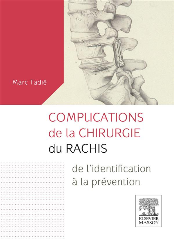 Complications de la chirurgie du rachis. De l'identification à la prévention